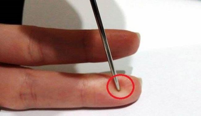حيلة عبقرية لإنقاذ حياة انسان.. حتى لو لم تكونوا أطباء!