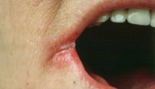 ملاحظة هذه العلامات تبعدك عن المرض !