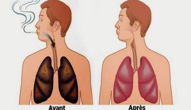 هذه الأطعمة تنظف رئتيكم من النيكوتين والقطران !