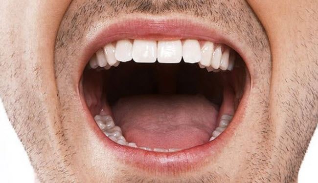 6 أشياء تخبركم بها الشفاه عن صحتكم!