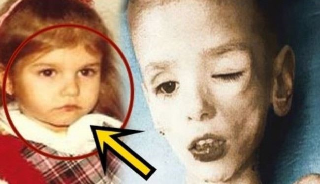 هذه أسوأ نهاية لطفلة ممثلة في هوليوود..أحرقها والدها بسبب نجاحها!!
