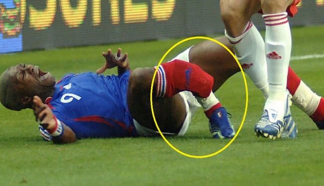 بالصور... عظام انفصلت عن بعضها على الهواء 18+