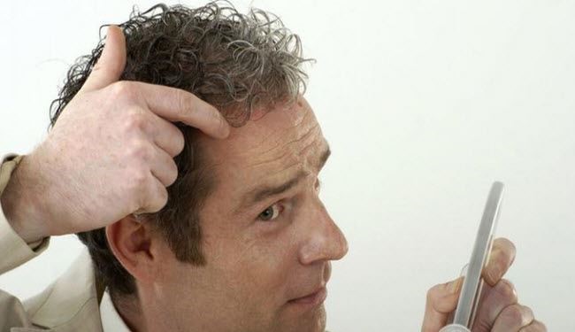 إليكم أفضل 6 طرق لمكافحة تساقط الشعر