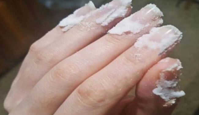 افركوا البيكنغ صودا على أظافركم.. ولاحظوا ما سيحدث!