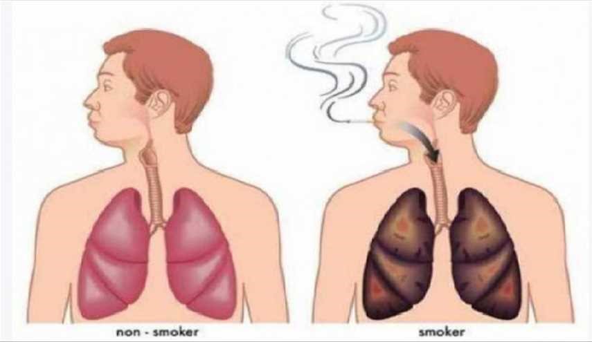 أفضل مشروب طبيعي يطهّر الرئتين من آثار التدخين
