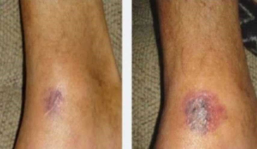 شعر بألمٍ في ساقه أثناء تنظيفه للأواني.. وبعد 4 أيام حدثت الكارثة!