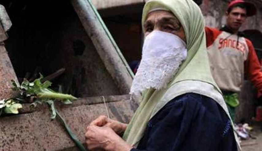 جنین سنگی 35 ساله در شکم مادر الجزایری+عکس