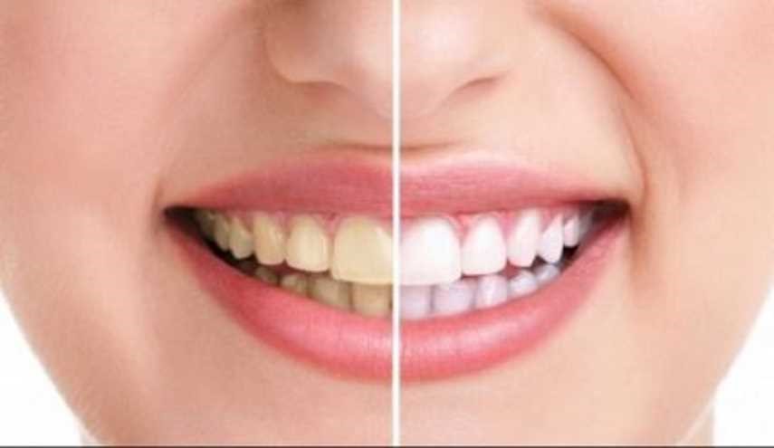 هكذا تتخلص من آلام الأسنان فورًا