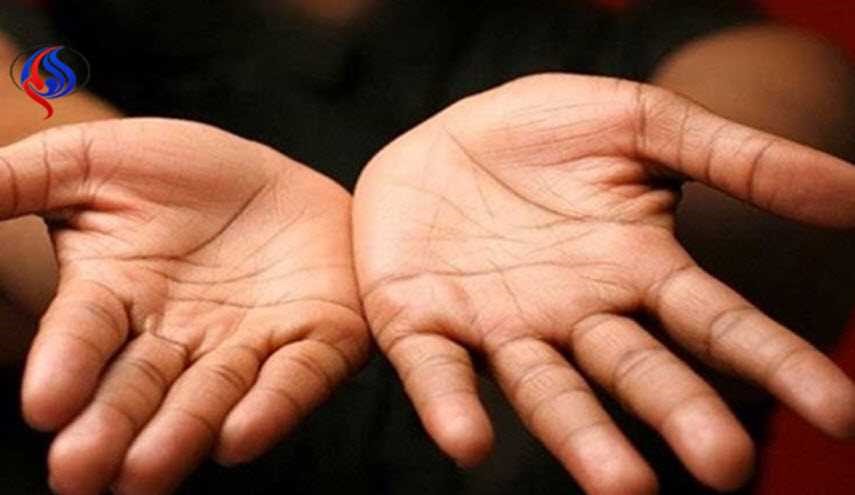 هل يظهر الحرف X على راحة يدك؟ إليك ما يعني هذا!