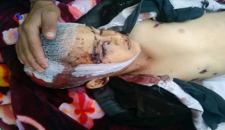 استشهاد 5 بينهم طفل وجرح 8 بانفجار قنبلة في مذيخرة إب