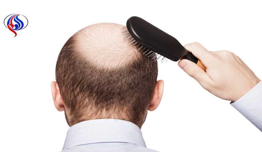 اكتشفوا صفات الرجال المعرضين للصلع مبكرا.. هل انتم منهم؟
