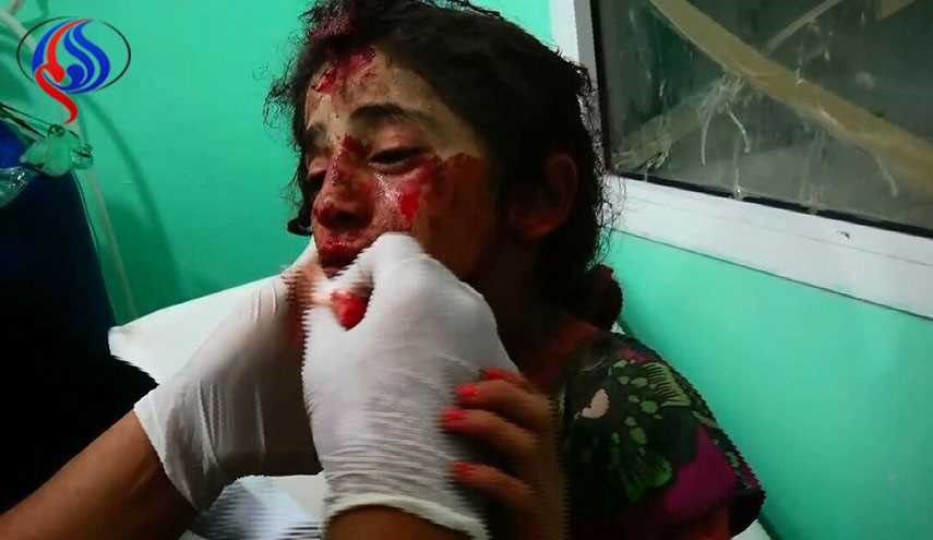 شاهد ماذا فعلت قنابل العدوان السعودي العنقودية بأطفال ونساء اليمن