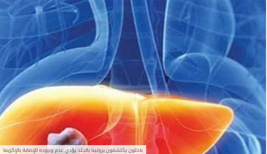 باحثون يكتشفون بروتينا بالجلد يؤدي عدم وجوده للإصابة بالإكزيما