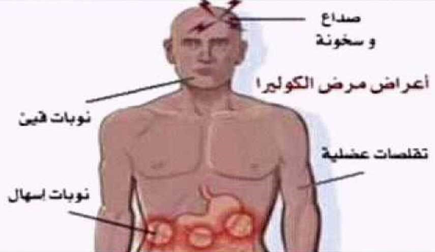 للأهمية .. هذه أعراض وطرق إنتشار وعلاج وباء (الكوليرا ) القاتل !