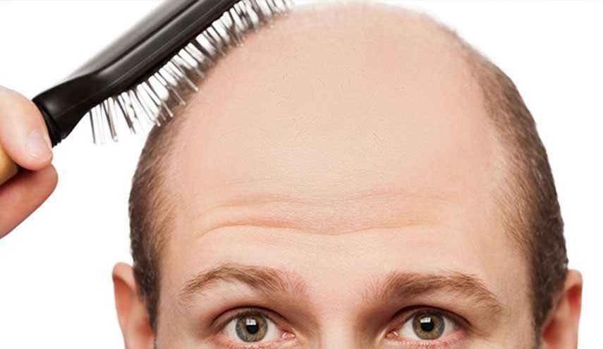 دراسة تكتشف بالصدفة علاجا للصلع والشيب وربما الشيخوخة