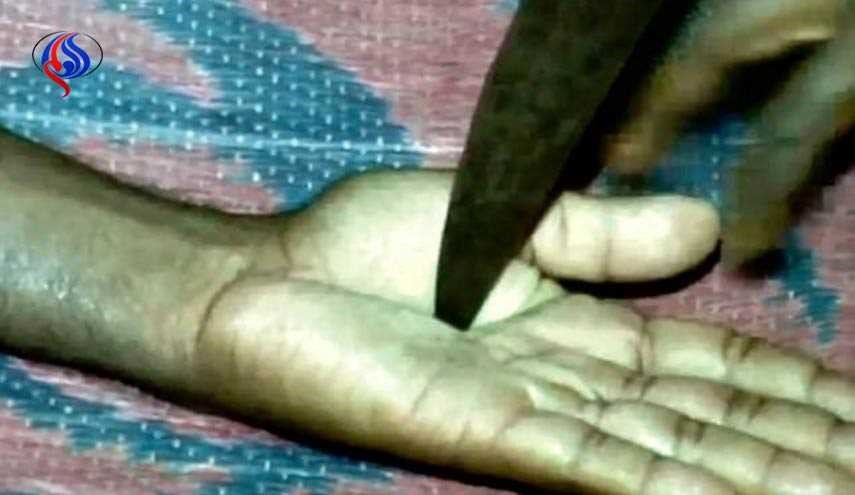 بالصور.. ساحرة تدعي علاج المرضى بـ