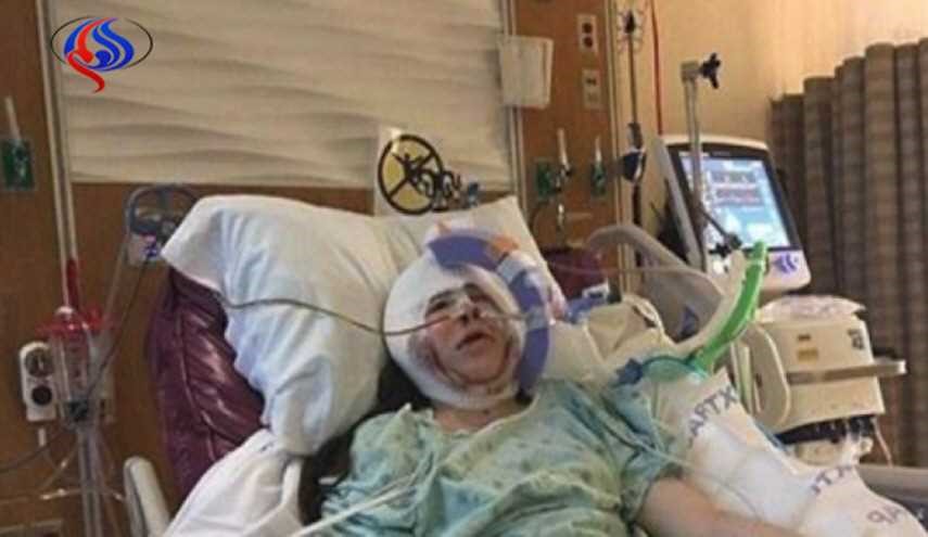 بالصور: إيفانكا ولدت بوجه غير مكتمل.. شاهدوا كيف أصبحت بعد التجميل!