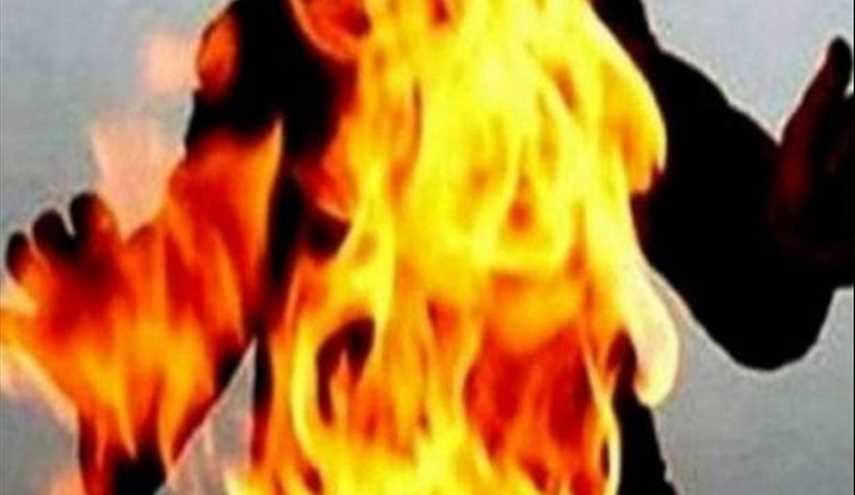 وفاة عاملة منزلية حرقاً من قبل أصحاب العمل!