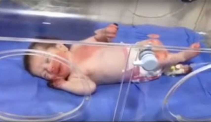 امريكية تقطع 10000 كم لتبني الطفلة المعجزة 