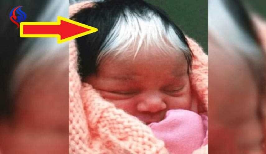 بالصور.. طفلة تولد بشعر غريب.. والمفاجأة الأكبر والدتها!