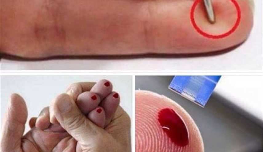 هكذا يمكنك إنقاذ إنسان من السكتة الدماغية !!