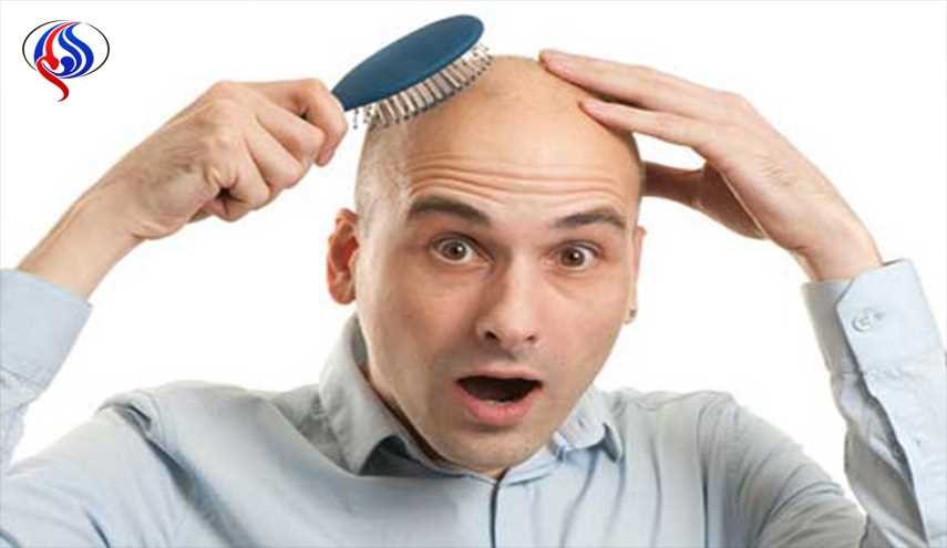 طريقة جديدة وفعالة لمكافحة الصلع...اكتشفها!