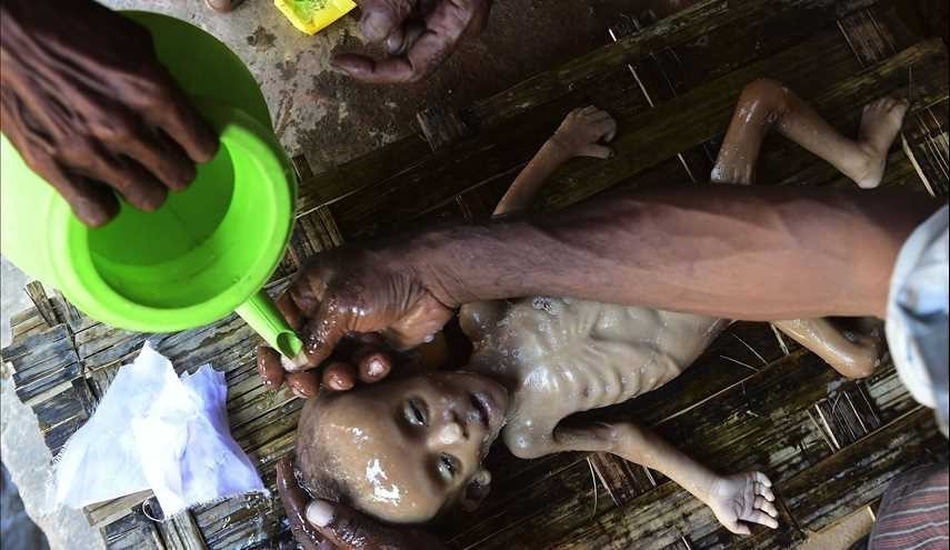 صور مؤلمة ... مسلمو ميانمار... بأي ذنب قتلت؟! (16+)