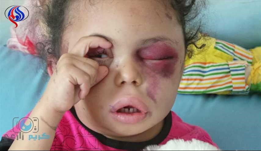 أول فنان عربي يتضامن مع أطفال اليمن ضد العدوان السعودي!