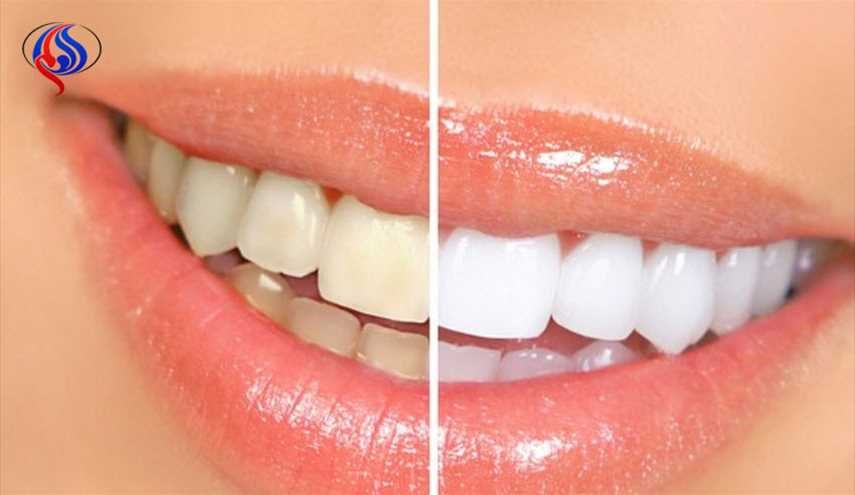 أقوى 10 أطعمة مسؤولة عن اصفرار الأسنان.. وكيفية إزالته