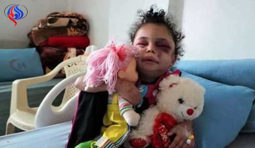 رئيس اللجنة الثورية اليمنية العليا: السعودية اختطفت الطفلة بثينه