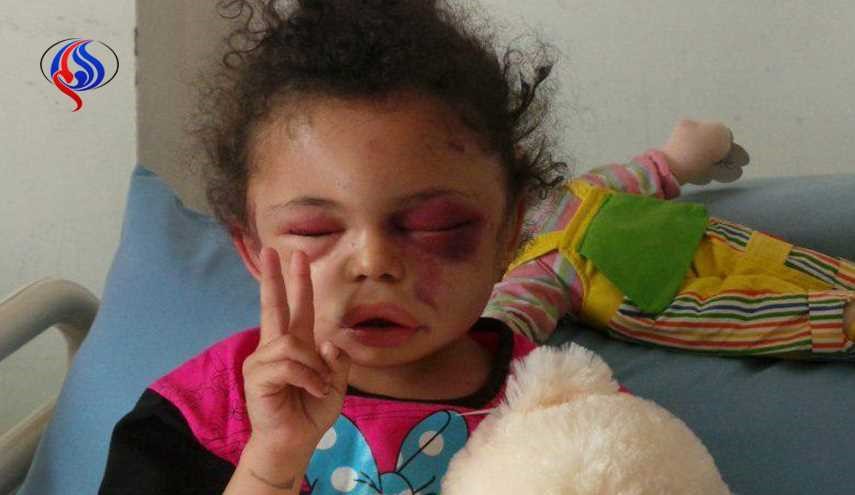 تفاصيل اختطاف الطفلة بثينة من قبل العدوان السعودي
