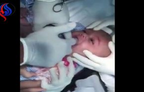 شاهد ماذا وجد الطبيب في فم طفل رضيع!
