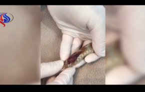 فيديو يحبس الأنفاس.. إنقاذ ثعبان خرج قلبه من جسده!