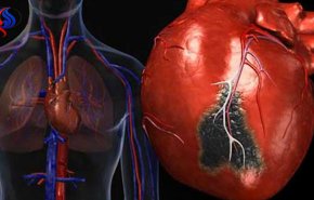 علاج مذهل لمرضى القلب... ماهو؟