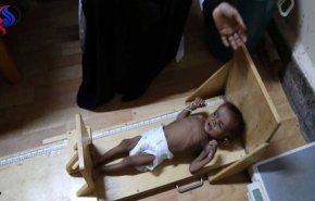 الامم المتحدة تحذر: أوضاع اليمنيين كالحال يوم القيامة