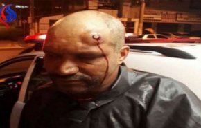 كيف علقت الرصاصة في جبينه؟!.. إليك التفسيرات