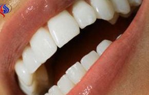 تخلص من اصفرار الأسنان حالًا، لا تؤجل الفكرة!
