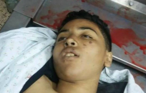 صورة..استشهاد طفل فلسطيني في غزة