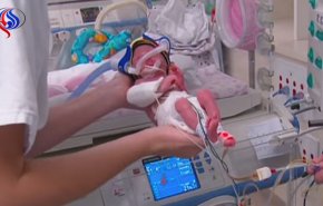 بالصور: معجزة طبية تمنح الحياة لرضيعة
