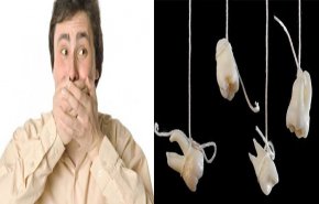 فقدان الأسنان علامة مرض قاتل!