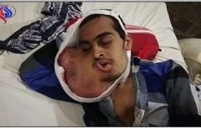 وفّر ثمن زيارة طبيب الاسنان.. والنتيجة سرطان قاتل في الفم!