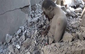 مجازر العدوان في اليمن.. عندما تسقط الأقنعة وينكشف المستور!