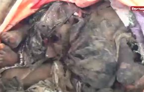 شاهد كيف طحنت غارة سعودية اطفال الدريهمي، واناملهم تفضح الجريمة المروعة