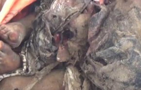 شاهد.. رحلات القتل والجوع تلاحق كل من يريد النجاة بنفسه باليمن