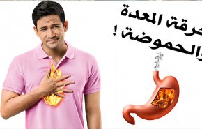 حرقة المعدة.. أسبابها وطريقة علاجها!
