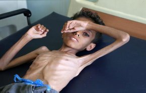 مهلة أميركية لوقف حرب اليمن وشبه خريطة طريق