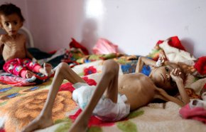 اليمن يواجه عدوانا من نوع آخر!

