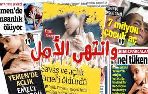 نهاية أمل.. قصة طفلة يمنية ماتت جوعاٌ