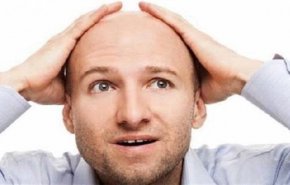 وداعا للصلع بهذه التقنية الجديدة!