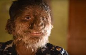 تعرف على قصة 'الطفل الذئب' في الهند